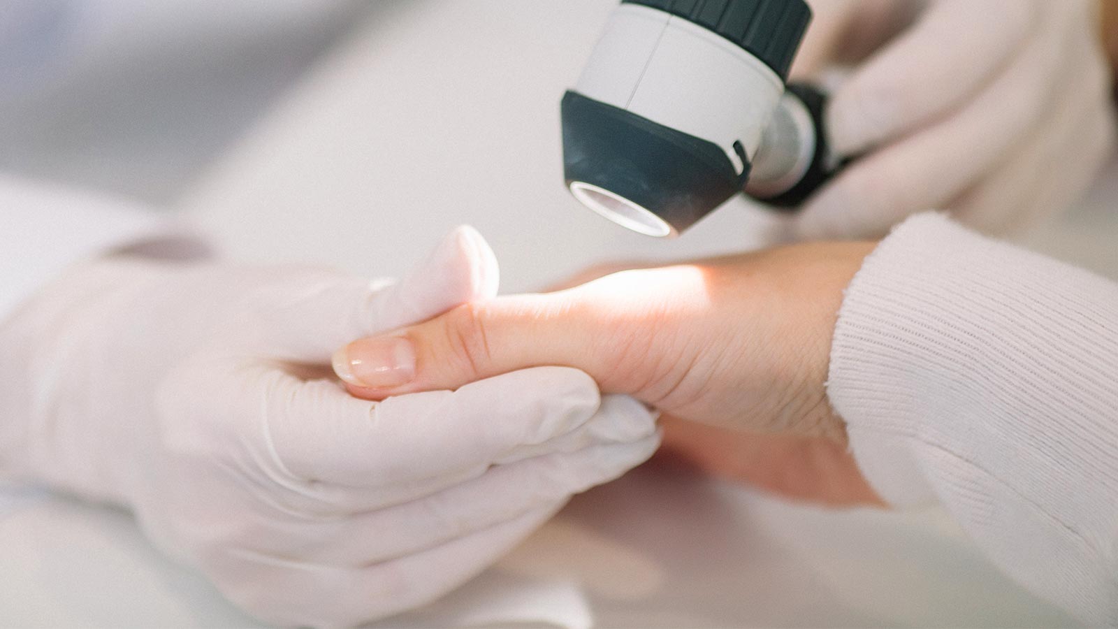 hidroclorotiazida medicamento diurético